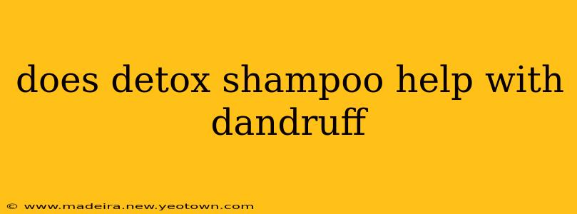does detox shampoo help with dandruff