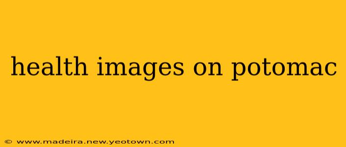 health images on potomac