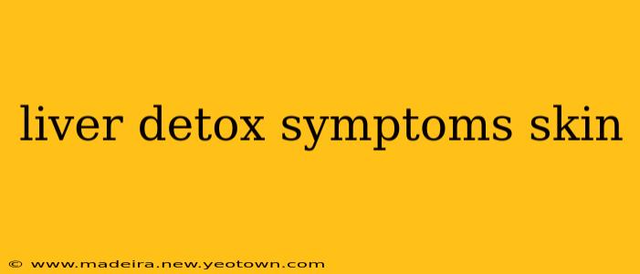 liver detox symptoms skin