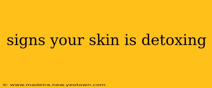 signs your skin is detoxing