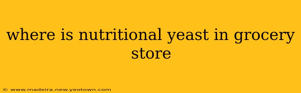 where is nutritional yeast in grocery store