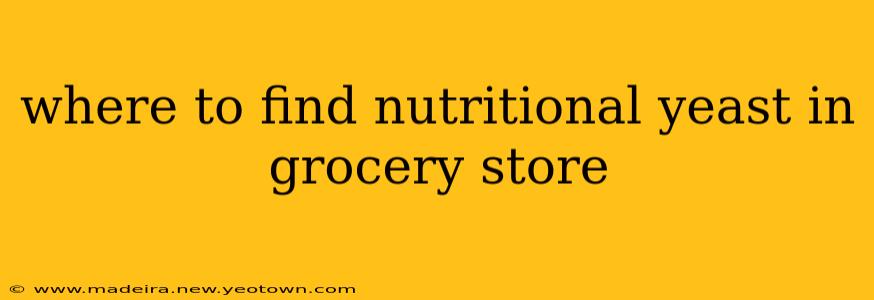 where to find nutritional yeast in grocery store