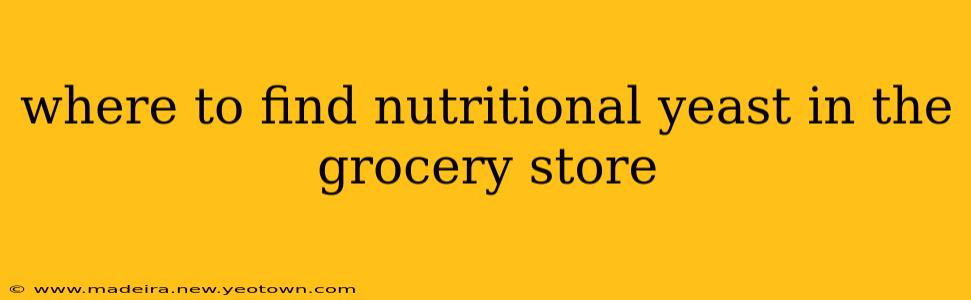 where to find nutritional yeast in the grocery store